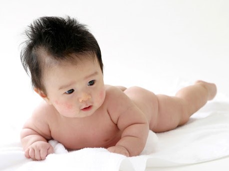 赤ちゃん　あせも　原因　